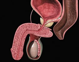 Métodos para el tratamiento de la prostatitis