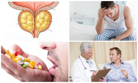 prostatitis en hombres